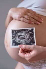 Imaging in IVF and Follicular Study in Mumbai | Naraya Healthcare