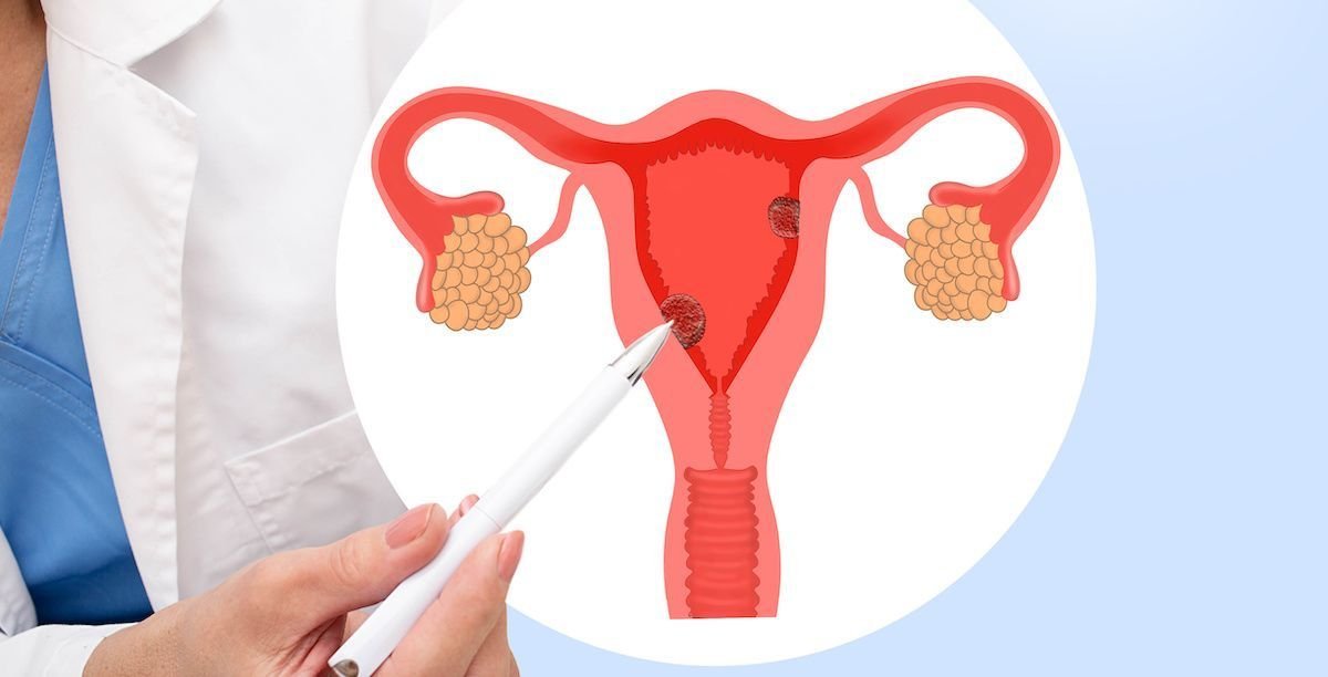Advanced Treatment Options