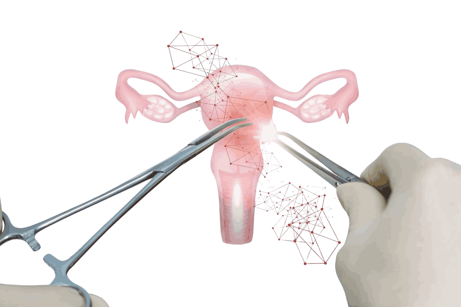 Types of Tubal Recanalization Surgery in Mumbai