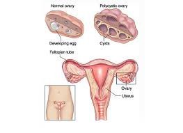 Fertility Enhancing Surgery In Mumbai
