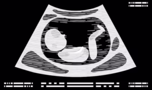 Prenatal imaging for fetal health
