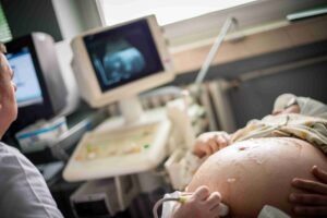 Keyhole surgery using minimally invasive laparoscopic technique