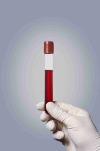 thyroid and hormonal blood tests in mumbai