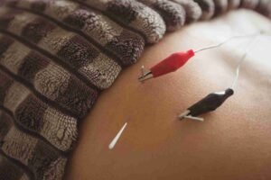 stress reduction acupuncture in mumbai 