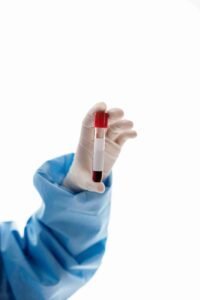 pathology lab blood test sample collection in mumbai 