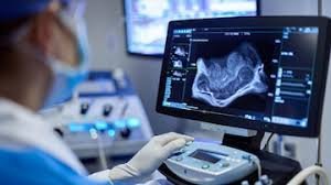 Ultrasound imaging scans at Naraya Health Mumbai
