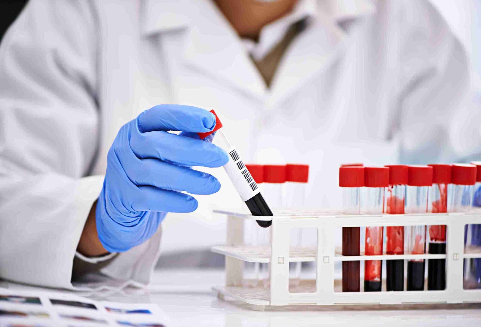 ready analyze some blood cropped shot male scientist conducting blood tests medical lab 11zon scaled