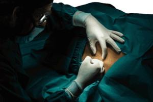 TOT urinary leak surgery procedure in Mumbai
